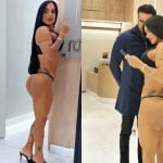 Kamila Simioni passa por procedimento para reparar danos causados por hidrogel no bumbum