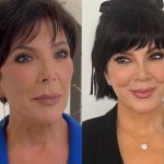 Mãe das Kardashians teria buscado “mestre do lifting facial” para renovar o visual