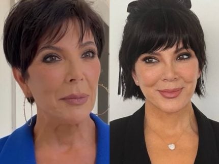 Kris Jenner teria passado por lifting facial