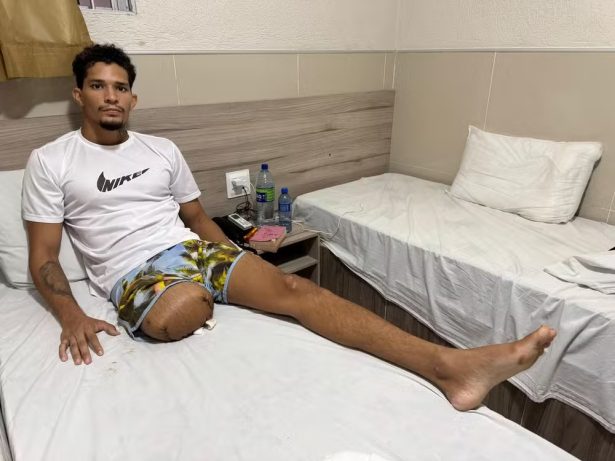 Jovem baleado por delegado em Noronha fala de luta pela vida e amputação