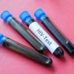 Cientistas registram avanço tido como “impossível” na busca pela cura do HIV. Entenda!