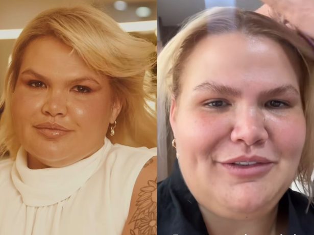 Thais Carla relata efeito colateral após bariátrica e tratamento: “Se agravou”