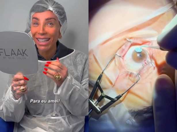 Ceratopigmentação: conheça o procedimento realizado por Maya para mudar a cor dos olhos