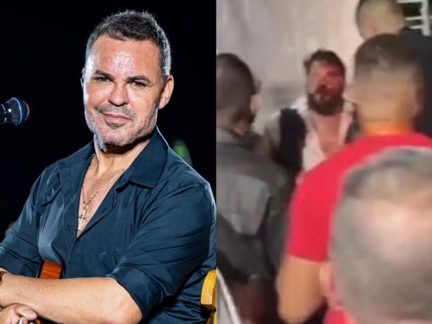 Cantor relata agressão por produtor de Eduardo Costa em show em GO: “Covarde”
