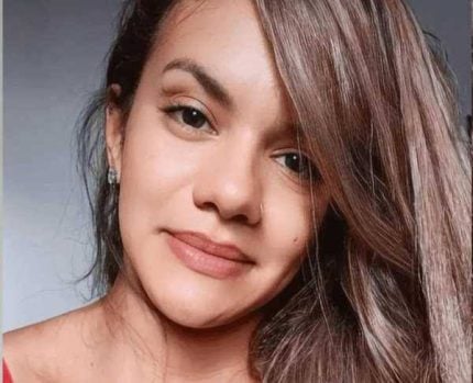 Mulher agredida com 61 socos passou por cirurgia de 7 horas para reconstrução da face