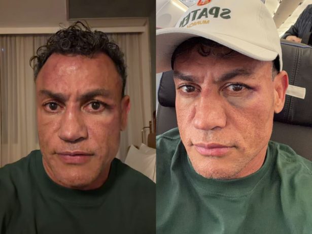 Popó se manifesta após briga generalizada em luta contra Wanderlei Silva