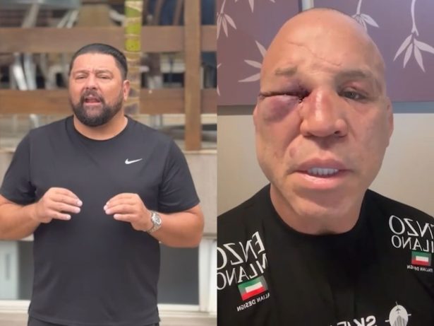 Defesa de Wanderlei afirma que tomará medidas criminais contra Popó por agressões