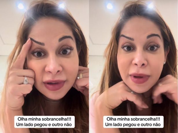 Maíra Cardi se desespera após botox deixar sobrancelhas tortas: “Cara endemoniada”