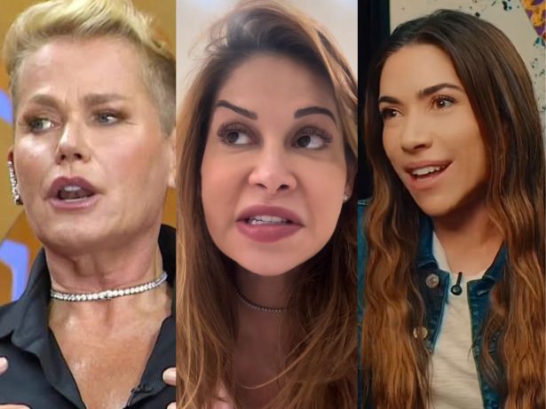 Maíra Cardi não está sozinha! Relembre famosas que já enfrentaram perrengues com procedimentos estéticos