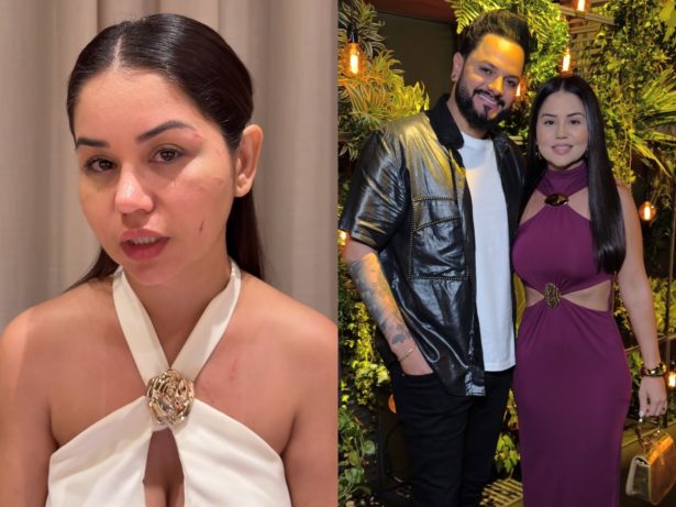 Esposa de Diego, dupla de Victor Hugo, é agredida por ex do cantor e expõe hematomas e ameaças