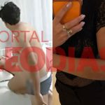 Imagens revelam hematomas de esposa agredida por cantor paraibano