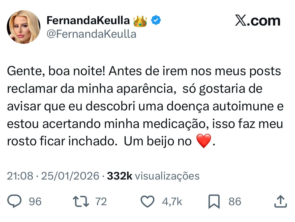 Foto/X