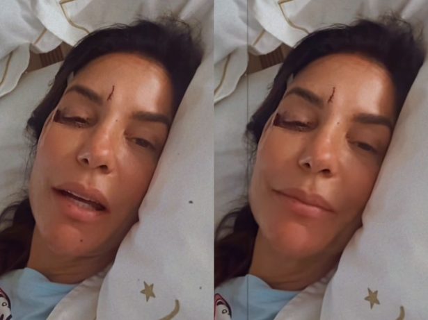 Ivete adianta alta hospitalar após cirurgia no rosto e agradece equipe médica: “Estou ótima”