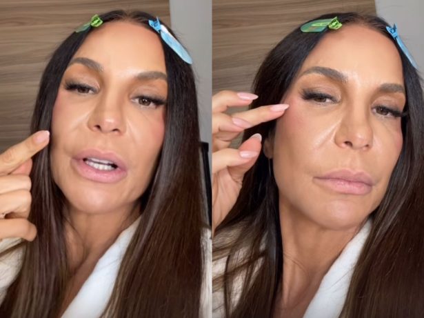 Ivete Sangalo atualiza recuperação após cirurgia no rosto e anuncia dias de folga