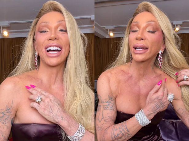 Maya Massafera mostra resultado da cirurgia de redução das costas e exibe ossos removidos