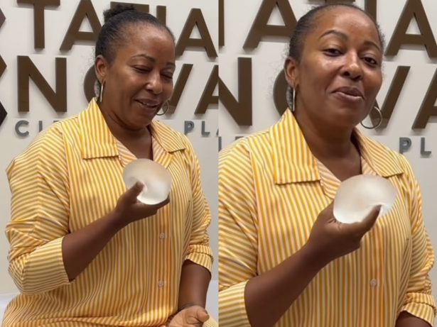 Tia Má revela cirurgia para retirar silicone após descobrir nódulos: “Muito medo”