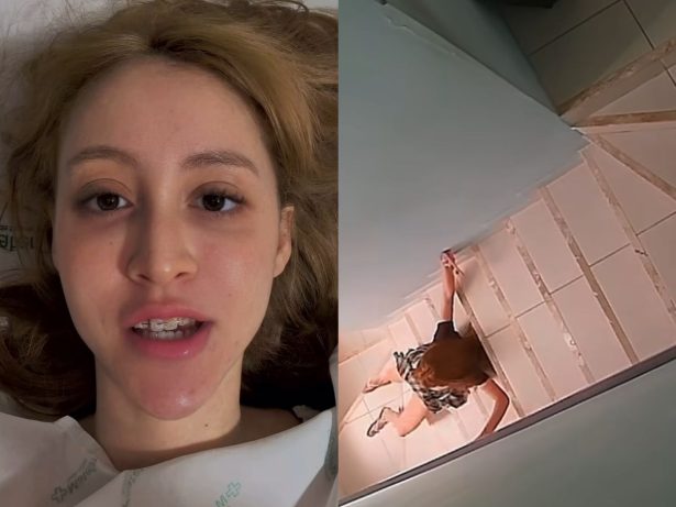 Influenciadora Hendyohara fratura a bacia após queda em escada: “Orem por mim”