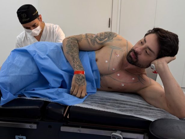 Rico Melquiades revela procedimento estético inusitado na região anal: “Cutox”