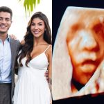 Arthur Aguiar acompanha Jheny Santucci em ultrassom após anúncio de separação