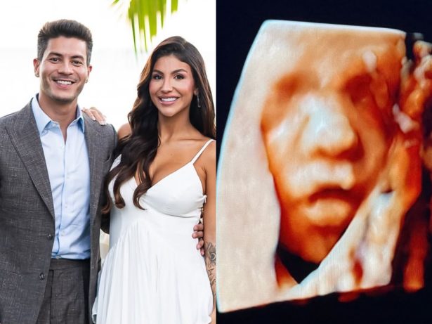 Arthur Aguiar acompanha Jheny Santucci em ultrassom após anúncio de separação