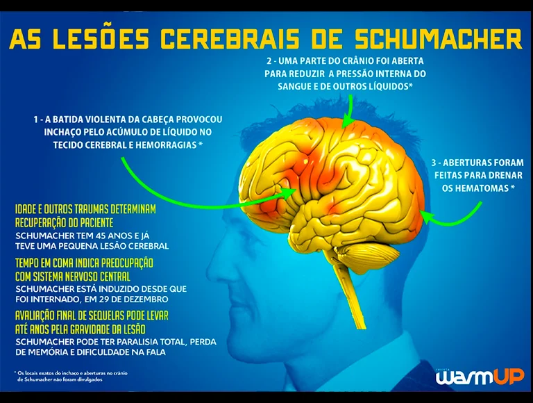 A situação de Schumacher é bem complexa e os familiares preferem não divulgar informações. Foto: Reprodução