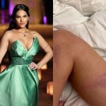 Emily diz que foi empurrada e teve cabelo puxado ao tentar pegar buquê em casamento