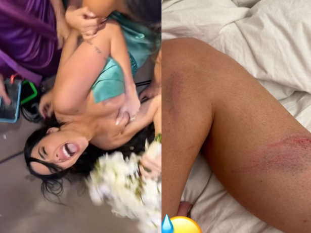 Emily Garcia sai com pernas machucadas de briga por buquê: “Pra que tanta raiva?”