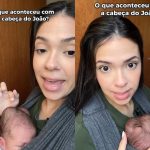 Influenciadora explica “calombos” na cabeça do filho e revela procedimento para o tratamento
