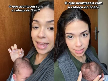 Influenciadora explica “calombos” na cabeça do filho e revela procedimento para o tratamento