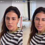 Sem mencionar recuperação, Simone Mendes exibe resultado de procedimento no nariz