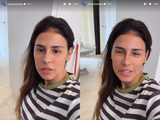 Sem mencionar recuperação, Simone Mendes exibe resultado de procedimento no nariz