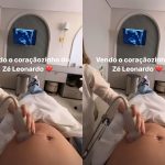 Grávida de 7 meses, Virginia mostra momento em que vê coração do filho