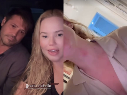 Namorada de Dado Dolabella formaliza denúncia após agressões e diz que foi coagida a negar o caso
