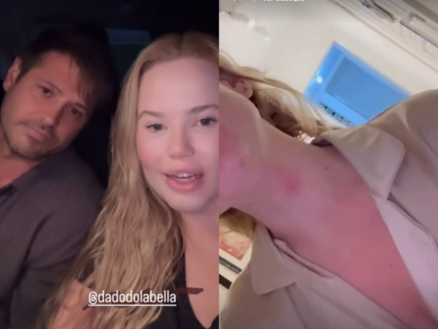 Namorada de Dado Dolabella formaliza denúncia após agressões e diz que foi coagida a negar o caso
