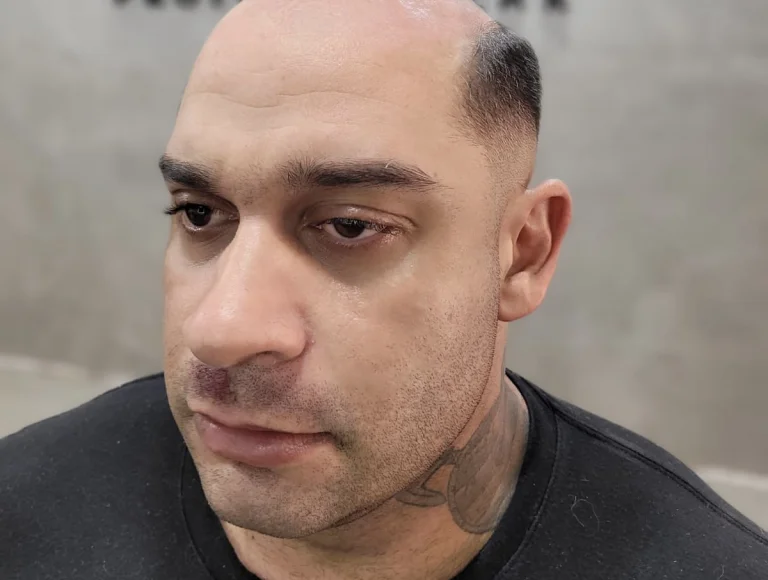 Descubra a Revolução Capilar em Magé: Prótese Capilar na Barbearia de Andre Ricci