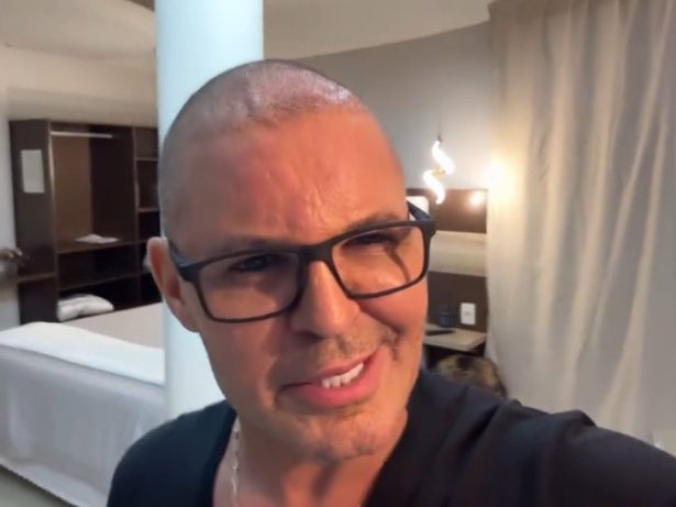 Após procedimento, Eduardo Costa aparece careca em show
