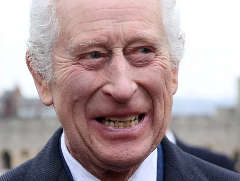 Entenda porque Rei Charles III está com sorriso amarelo e torto