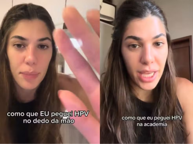 É possível pegar HPV na academia? Médico responde ao portal LeoDias!