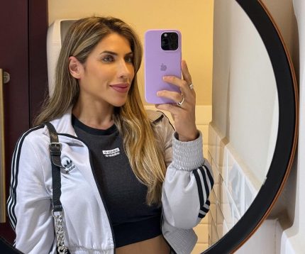 Ana Paula Minerato sofre com deslocamento de hidrogel pelo corpo e passará pela terceira cirurgia de retirada da substância (Reprodução / Instagram)