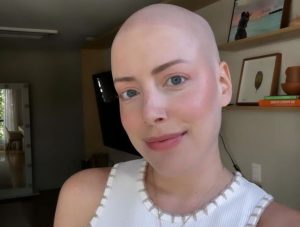 Em tratamento contra leucemia, Fabiana Justus conta que ainda sente que tem cabelo