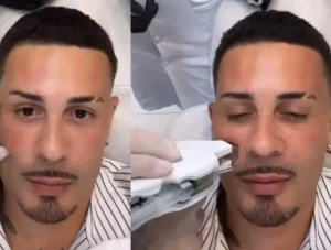 Carlinhos Maia aplica esperma de salmão no rosto para tratamento facial. Entenda!