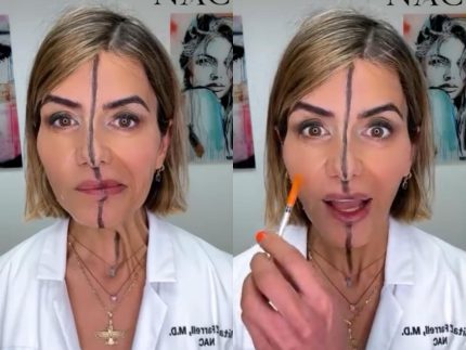 Quem sabe faz ao vivo! Médica aplica Botox no próprio rosto e surpreende internautas