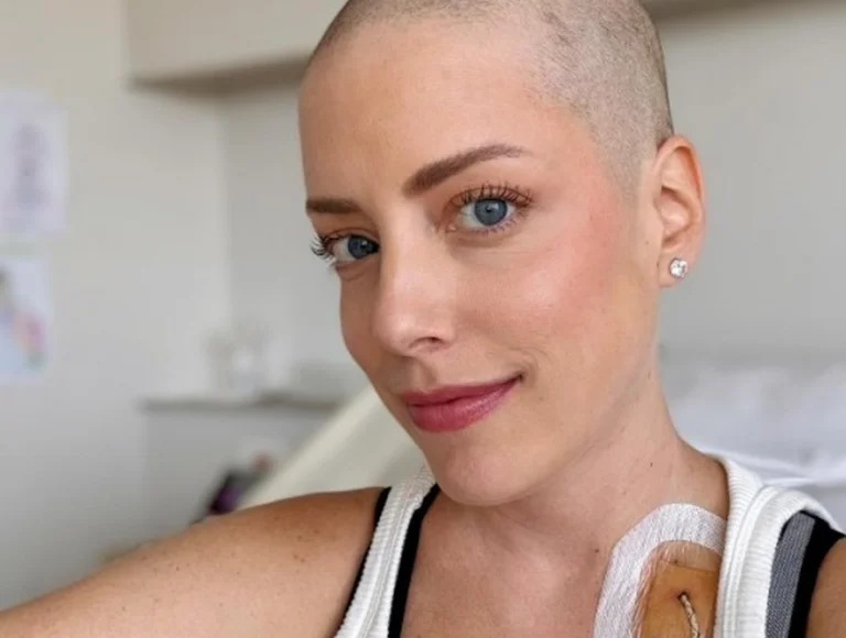 Fabiana Justus decide raspar cabelo em tratamento contra leucemia