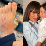“Não deixem de lavar roupas novas”, alerta Fernanda Lacerda após filho ter sarna