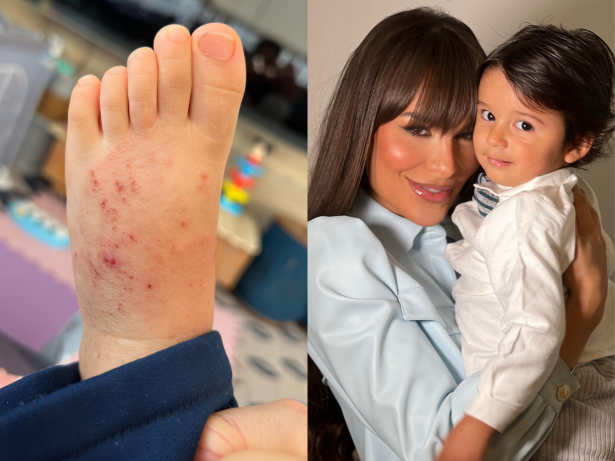 “Não deixem de lavar roupas novas”, alerta Fernanda Lacerda após filho ter sarna