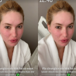 Após procedimento a laser, Virginia reaparece e explica tratamento no rosto