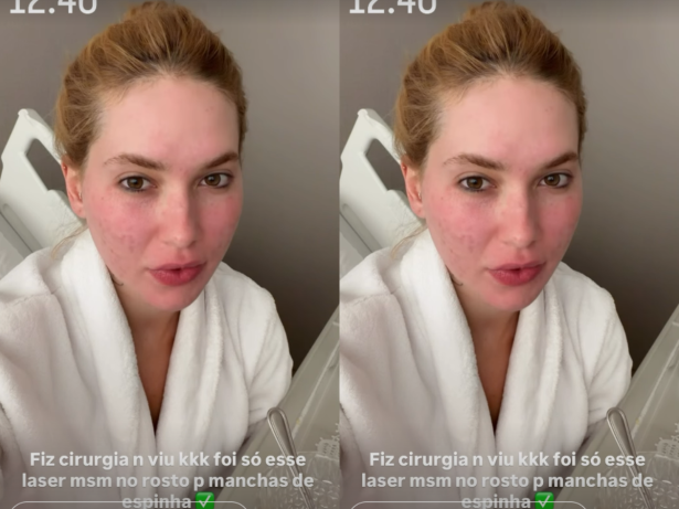Após procedimento a laser, Virginia reaparece e explica tratamento no rosto