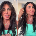 Boca, bochecha e mandíbula: Gretchen exibe resultado de nova harmonização facial