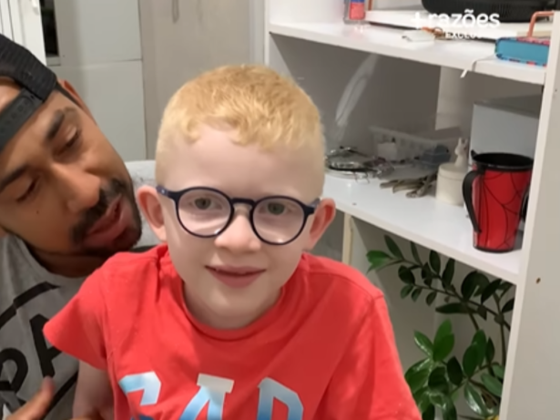 Menino com retina albina enxerga pela primeira vez e emociona a web