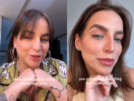 Bruna Unzueta choca seguidores com antes e depois do rosto após emagrecer 20 kg